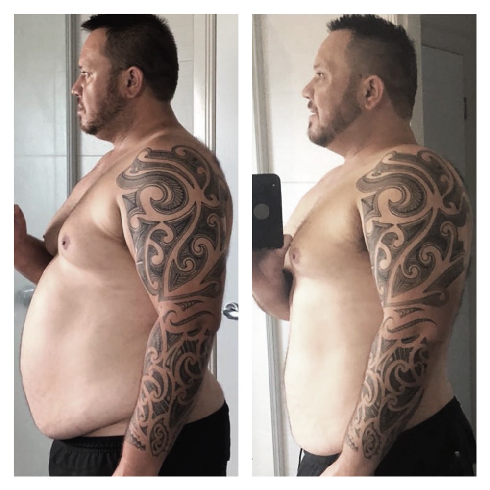 Before and After photos of a man who has lost weight. His side profile is visable.