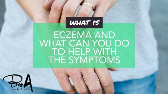 What is eczema and what can you do to help with the symptoms? What is eczema and what can you do to help with the symptoms?
