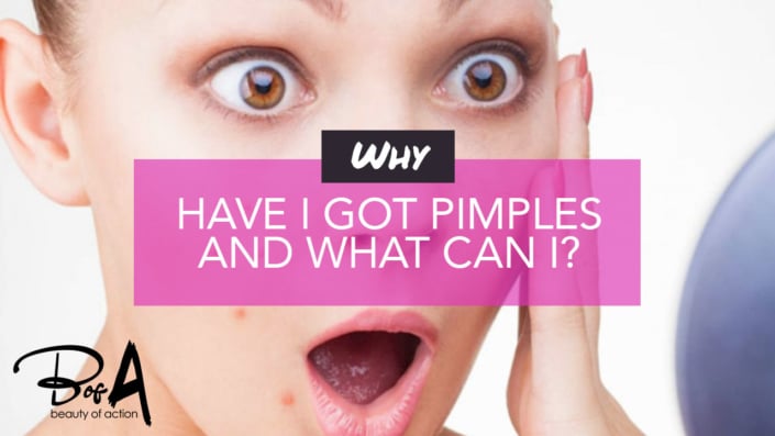 Why have I got pimples and what can I do? Why have I got pimples and what can I do?
