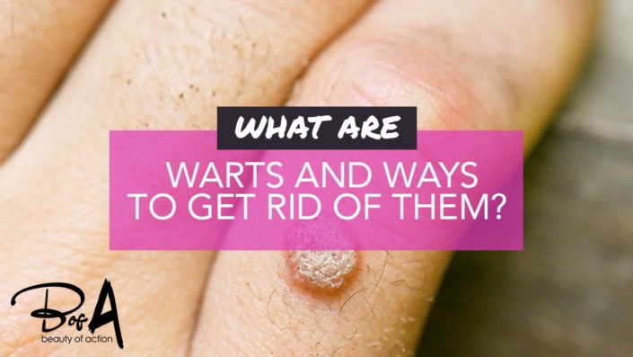 What are warts and how to get rid of them What are warts and how to get rid of them