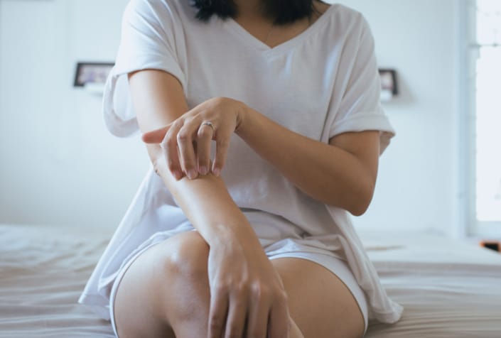 Image of a female arms - her one hand is scratching her other arm