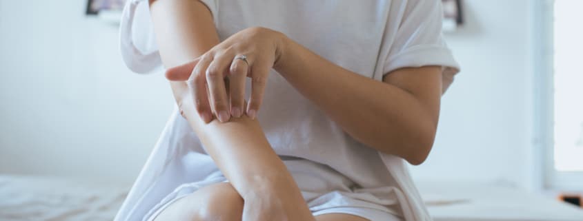 Image of a female arms - her one hand is scratching her other arm